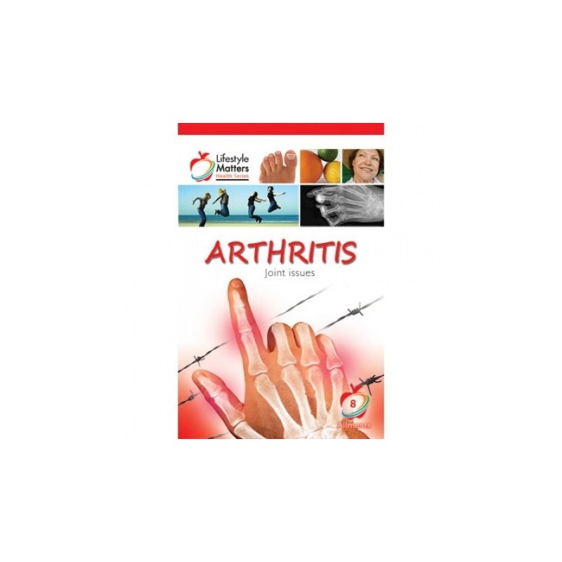 Arthritis - Pocket Books