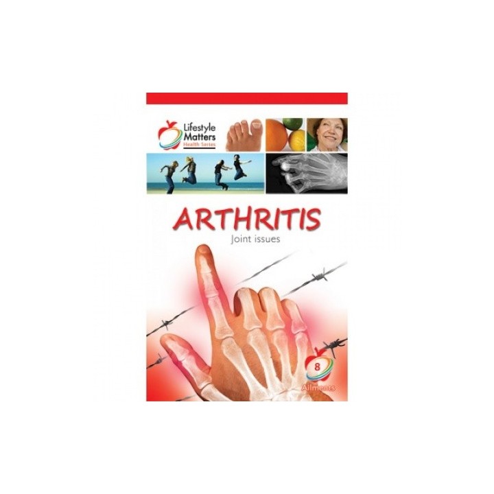 Arthritis - Pocket Books